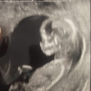 Meet your Posher, Aries